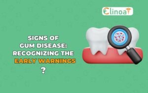 Signs of Gum Disease Recognizing the Early Warnings - Clinoa is a Best Dentist in Pondicherry